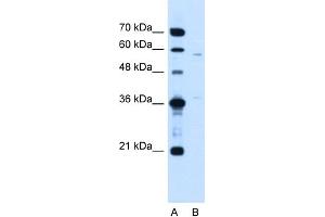 WB Suggested Anti-MGC39633 Antibody Titration:  1. (MGC39633 (N-Term) 抗体)