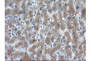 Immunohistochemical staining of paraffin-embedded liver tissue using anti-CYP1A2 mouse monoclonal antibody. (CYP1A2 抗体)