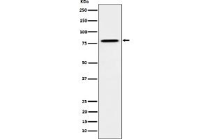 Western blot analysis of MUTA expression in HeLa cell lysate. (Recombinant MUT 抗体)