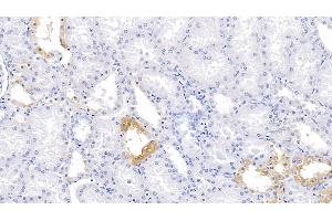 Detection of PBRM1 in Human Kidney Tissue using Polyclonal Antibody to Polybromo 1 (PBRM1) (Polybromo 1 抗体  (AA 1-306))