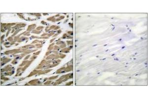 Immunohistochemistry analysis of paraffin-embedded human heart tissue, using Sodium Channel-pan Antibody. (Sodium Channel 抗体  (AA 1466-1515))