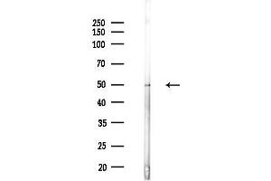 Western blot analysis of lysates from COLO205 cells(heat-shock,45 min treatment), using -H6 Antibody at 1/1000 dilution.