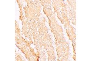 Immunohistochemistry (IHC) image for anti-Vacuolar Protein Sorting 39 Homolog (VPS39) (C-Term) antibody (ABIN1030796) (VPS39 抗体  (C-Term))