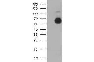 HEK293T cells were transfected with the pCMV6-ENTRY control (Left lane) or pCMV6-ENTRY AFP (Right lane) cDNA for 48 hrs and lysed. (alpha Fetoprotein 抗体)