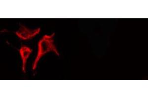 ABIN6266606 staining LOVO cells by IF/ICC. (Osteopontin 抗体  (C-Term))