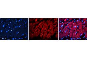 Rabbit Anti-INSR Antibody   Formalin Fixed Paraffin Embedded Tissue: Human heart Tissue Observed Staining: Cytoplasmic Primary Antibody Concentration: 1:100 Other Working Concentrations: 1:600 Secondary Antibody: Donkey anti-Rabbit-Cy3 Secondary Antibody Concentration: 1:200 Magnification: 20X Exposure Time: 0. (Insulin Receptor 抗体  (Middle Region))