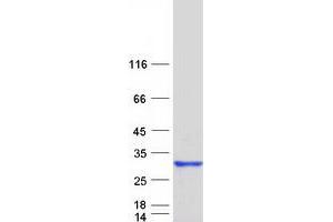 Validation with Western Blot