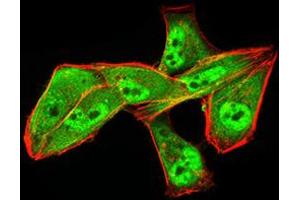 Immunocytochemistry (ICC) image for anti-Aldehyde Dehydrogenase 6 Family, Member A1 (ALDH6A1) (AA 1-195) antibody (ABIN5856297) (ALDH6A1 抗体  (AA 1-195))