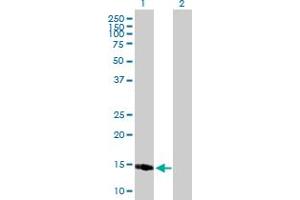 Western Blotting (WB) image for anti-Protein Phosphatase 1, Regulatory (Inhibitor) Subunit 1C (PPP1R1C) (AA 1-109) antibody (ABIN531020)