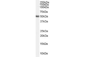 Image no. 1 for anti-Fatty Acid Desaturase 1 (FADS1) (Internal Region) antibody (ABIN374860) (FADS1 抗体  (Internal Region))