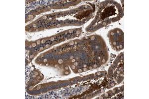 Immunohistochemical staining of human duodenum with FAM185A polyclonal antibody  strong cytoplasmic positivity in glandular cells at 1:50-1:200 dilution. (FAM185A 抗体)