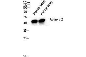 Western Blot (WB) analysis of specific cells using Actin alpha3 Polyclonal Antibody. (Actin Alpha3 (N-Term) 抗体)