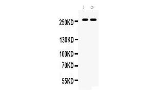 Western blot analysis of ABCA4 expression in rat eye extract ( Lane 1) and mouse eye extract ( Lane 2). (ABCA4 抗体  (C-Term))