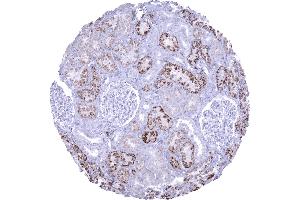 Moderate Napsin A immunostaining in proximal tubuli of the kidney (Recombinant NAPSA 抗体  (AA 189-299))