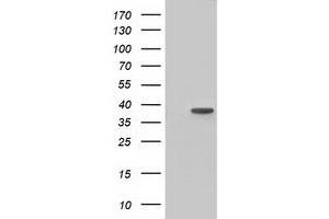 Western Blotting (WB) image for anti-3-hydroxyisobutyryl-CoA Hydrolase (HIBCH) antibody (ABIN1498655) (HIBCH 抗体)
