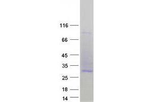 CD53 Protein (CD53) (Transcript Variant 2) (Myc-DYKDDDDK Tag)