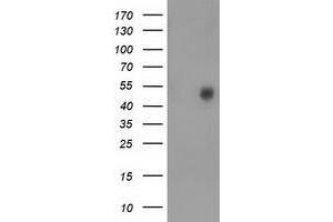 HEK293T cells were transfected with the pCMV6-ENTRY control (Left lane) or pCMV6-ENTRY BEST3 (Right lane) cDNA for 48 hrs and lysed. (Bestrophin 3 抗体)