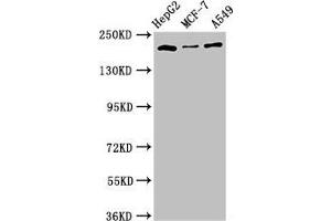 Western Blot Positive WB detected in: HepG2 whole cell lysate, MCF-7 whole cell lysate, A549 whole cell lysate, All lanes: OBSL1 antibody at 2. (Obscurin-Like 1 (OBSL1) (AA 1-61) 抗体)