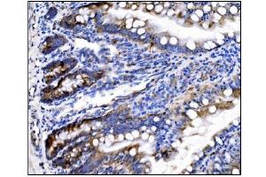IHC analysis of HCCS using anti-HCCS antibody (ABIN7602424).