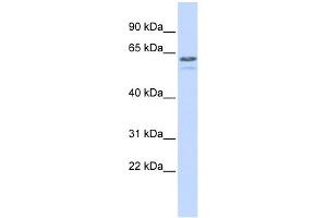 WB Suggested Anti-TRIM6 Antibody Titration:  0. (TRIM6 抗体  (N-Term))