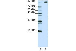 SF3B1 antibody used at 1. (SF3B1 抗体  (Middle Region))