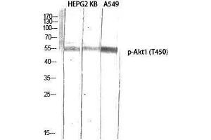Western Blotting (WB) image for anti-V-Akt Murine Thymoma Viral Oncogene Homolog 1 (AKT1) (pThr450) antibody (ABIN3172849) (AKT1 抗体  (pThr450))