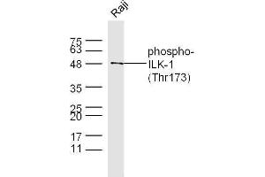 Raji cell lysates probed with Rabbit Anti-ILK-1(Thr173) Polyclonal Antibody, Unconjugated  at 1:500 for 90 min at 37˚C. (ILK 抗体  (pThr173))