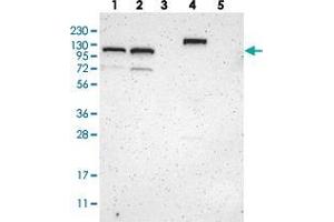 Western blot analysis of Lane 1: RT-4, Lane 2: U-251 MG, Lane 3: Human Plasma, Lane 4: Liver, Lane 5: Tonsil with ZBTB11 polyclonal antibody  at 1:250-1:500 dilution. (ZBTB11 抗体)