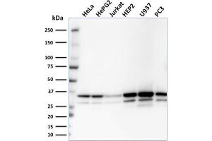 Western Blot Analysis of HeLa, HepG2, Jurkat, HEP2, U937, PC3 cell lysates using MDH1 Mouse Monoclonal Antibody (CPTC-MDH1-1).