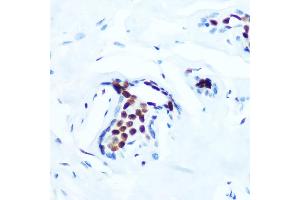 Immunohistochemistry of paraffin-embedded human breast using Phospho-c-Jun-T91 Rabbit mAb (ABIN7268057) at dilution of 1:100 (40x lens). (C-JUN 抗体  (pThr91))