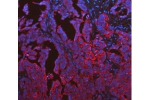 IF analysis of Cytokeratin 19 using anti-Cytokeratin 19 antibody (ABIN3043288). (Cytokeratin 19 抗体  (C-Term))