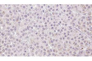 Immunohistochemistry (IHC) image for anti-Protein S (PROS) (N-Term) antibody (ABIN6264441)
