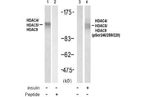 Image no. 1 for anti-HDAC4,HDAC5,HDAC9 (pSer220), (pSer246), (pSer259) antibody (ABIN319280) (HDAC4/HDAC5/HDAC9 抗体  (pSer220, pSer246, pSer259))