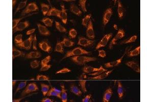 Immunofluorescence analysis of U-2 OS cells using ERK1 / ERK2 Polyclonal Antibody at dilution of 1:100 (40x lens). (ERK1/2 抗体)