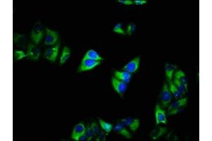 Immunofluorescence (IF) image for anti-Calcium Channel, Voltage-Dependent, alpha 2/delta Subunit 1 (CACNA2D1) (AA 577-717) antibody (ABIN7175577)