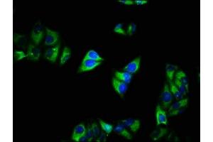 Immunofluorescence staining of Hela cells with ABIN7175577 at 1:200, counter-stained with DAPI. (CACNA2D1 抗体  (AA 577-717))