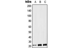 Western blot analysis of LIF expression in Jurkat (A), NIH3T3 (B), PC12 (C) whole cell lysates. (LIF 抗体  (Center))