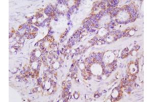 anti-Lectin, Galactoside-Binding, Soluble, 3 Binding Protein (LGALS3BP) (AA 301-400) antibody