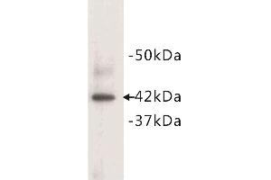 Western blot analysis of mouse heart tissue lysate, using alpha Actin (Cardiac actin) antibody. (ACTC1 抗体  (N-Term))