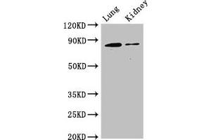 Western Blot Positive WB detected in: Mouse lung tissue, Mouse kidney tissue All lanes: CDH5 antibody at 3 μg/mL Secondary Goat polyclonal to rabbit IgG at 1/50000 dilution Predicted band size: 88, 75 kDa Observed band size: 88 kDa (Cadherin 5 抗体  (AA 349-569))