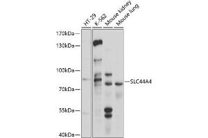 Western blot analysis of extracts of various cell lines, using SLC44 antibody (ABIN6130964, ABIN6148004, ABIN6148005 and ABIN6214687) at 1:1000 dilution. (SLC44A4 抗体  (AA 65-215))
