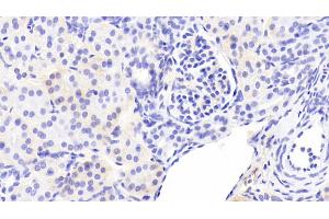 Immunohistochemistry (IHC) image for anti-ATPase, Ca++ Transporting, Cardiac Muscle, Slow Twitch 2 (ATP2A2) (AA 315-756) antibody (ABIN7436261)