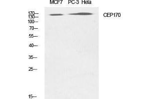 Western Blotting (WB) image for anti-Centrosomal Protein 170kDa (CEP170) (Internal Region) antibody (ABIN3174342) (CEP170 抗体  (Internal Region))