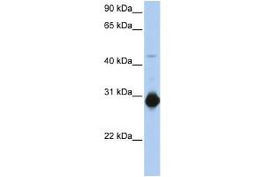 WB Suggested Anti-RHOU Antibody Titration:  0. (RHOU 抗体  (C-Term))