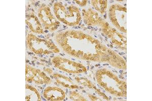 Immunohistochemistry of paraffin-embedded human kidney using CDC42 antibody at dilution of 1:200 (x400 lens) (CDC42 抗体)