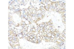 Immunohistochemistry (Paraffin-embedded Sections) (IHC (p)) image for anti-ATPase, Na+/K+ Transporting, beta 1 Polypeptide (ATP1B1) antibody (ABIN7257517)