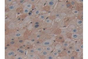 Immunohistochemistry (IHC) image for anti-Serpin Family C Member 1 (SERPINC1) antibody (ABIN7426502)
