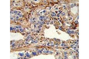 Immunohistochemistry (IHC) image for anti-Cyclin-Dependent Kinase 4 (CDK4) (AA 273-305) antibody (ABIN3030613)