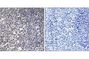 Immunohistochemistry analysis of paraffin-embedded human tonsil tissue, using MRPS16 Antibody. (MRPS16 抗体  (AA 81-130))