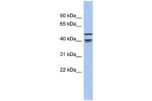 WB Suggested Anti-APOBEC4 Antibody Titration: 0. (APOBEC4 抗体  (Middle Region))